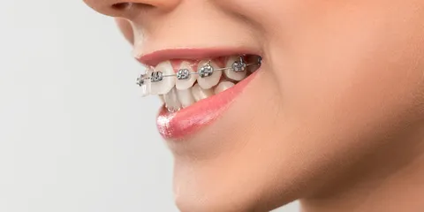 Dysgnathie-Behandlungen